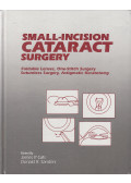 James P. Gills,Donald R. Sanders - Small-Incision Cataract Surgery