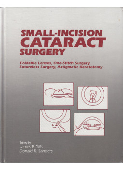 James P. Gills, Donald R. Sanders - Small-Incision Cataract Surgery James P. Gills, Donald R. Sanders - Small-Incision Cataract Surgery, Thorofare 1990 antikvár könyv
