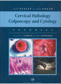 Szalay László, Ungár László - Cervical Pathology Colposcopy and Cytology Szalay László, Ungár László - Cervical Pathology Colposcopy and Cytology, Győr 2007 antikvár könyv