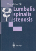 Varga Péter Pál - Lumbalis spinalis stenosis