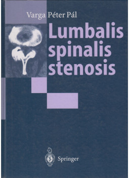 Varga Péter Pál - Lumbalis spinalis stenosis Varga Péter Pál - Lumbalis spinalis stenosis, Budapest 1995 antikvár könyv